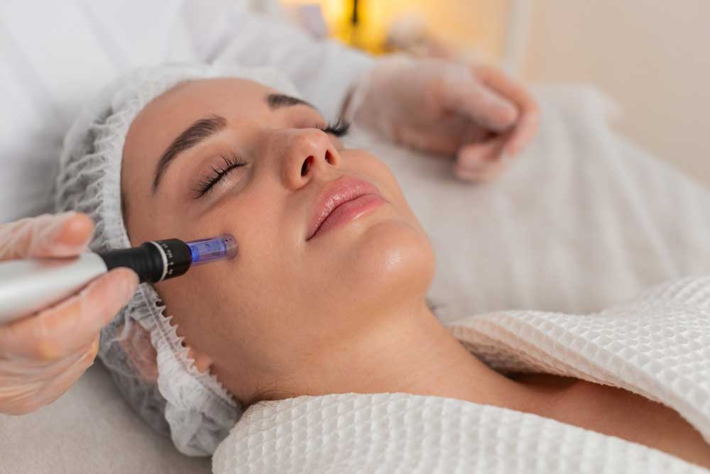 patient with microneedling treatment